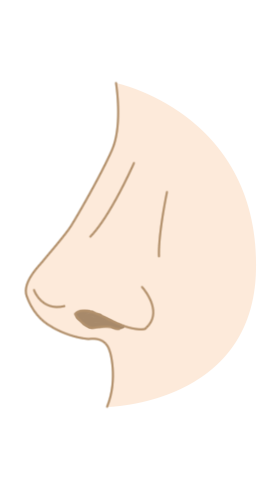 Nose Surgery